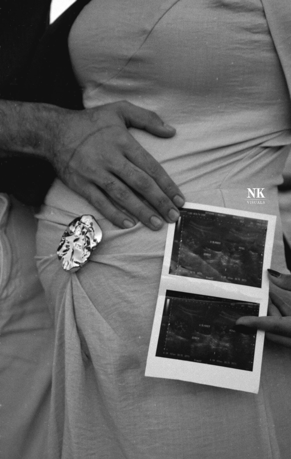 Black-and-white maternity portrait with ultrasound prints